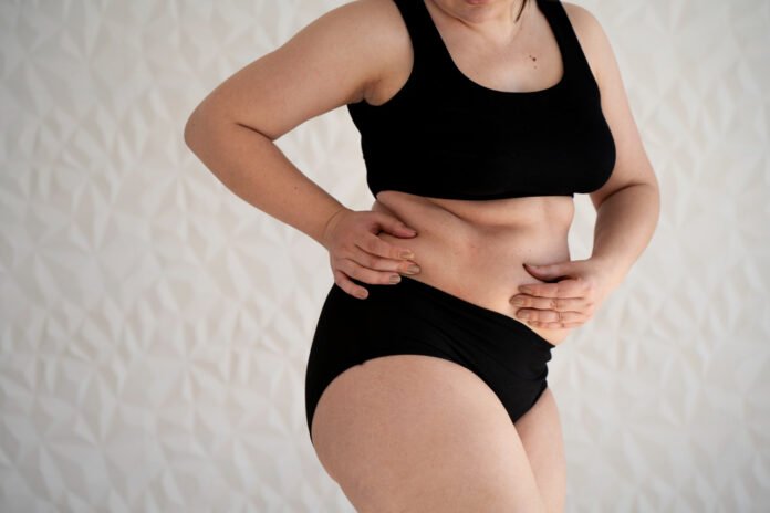 mulher em traje de banho, pinchando as gorduras abdominais com os dedos.